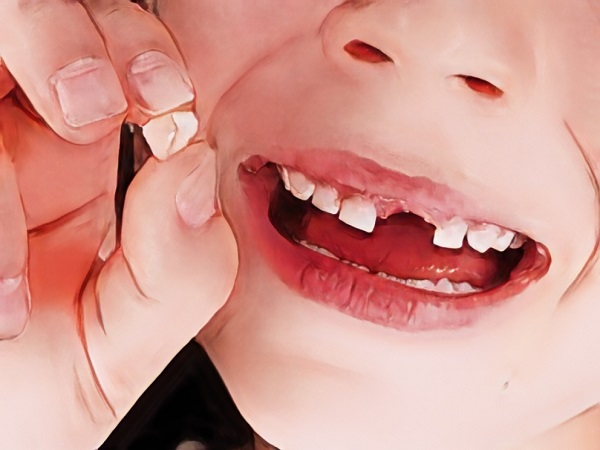儿童乳牙的生长发育及换牙顺序和时间