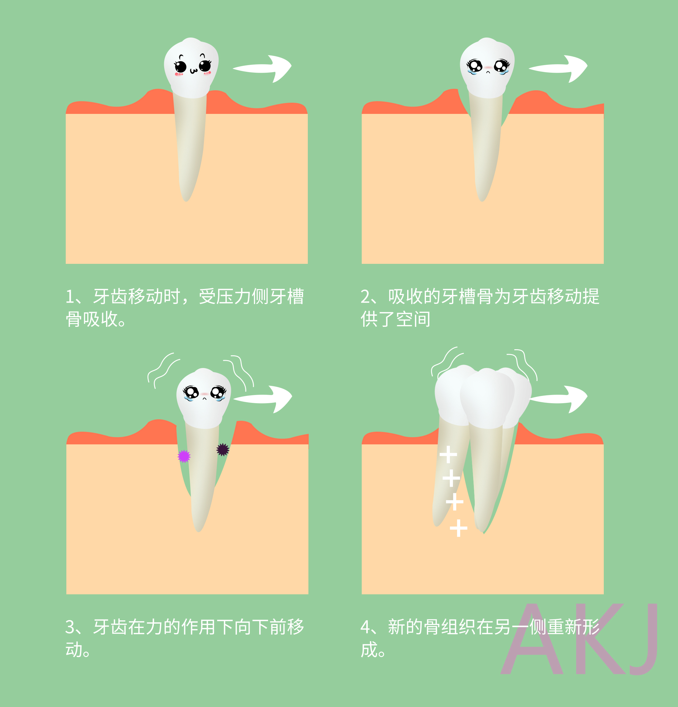矫正牙齿有哪些步骤