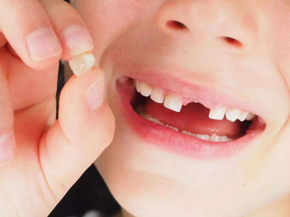 孩子换牙期全面指南：关键时间点与护理要点