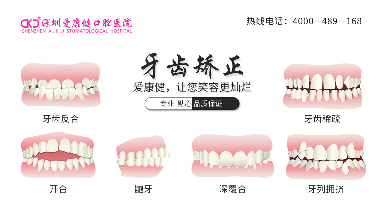 牙齿矫正的治疗方案：隐形矫正与舌侧矫正技术